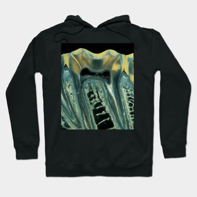 Tooth, light micrograph (C028/6621) Hoodie by SciencePhoto